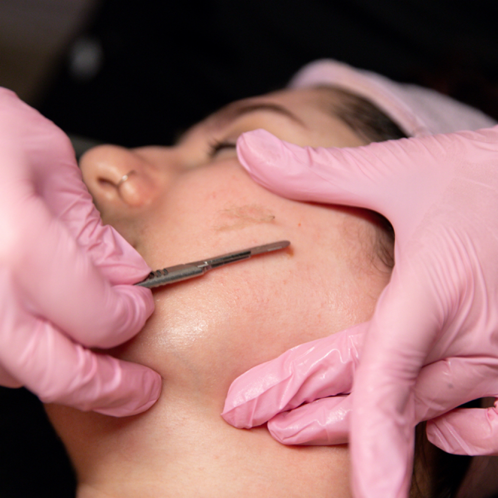 Blossom Facial at Skin Magician Studios in Kansas City, MO