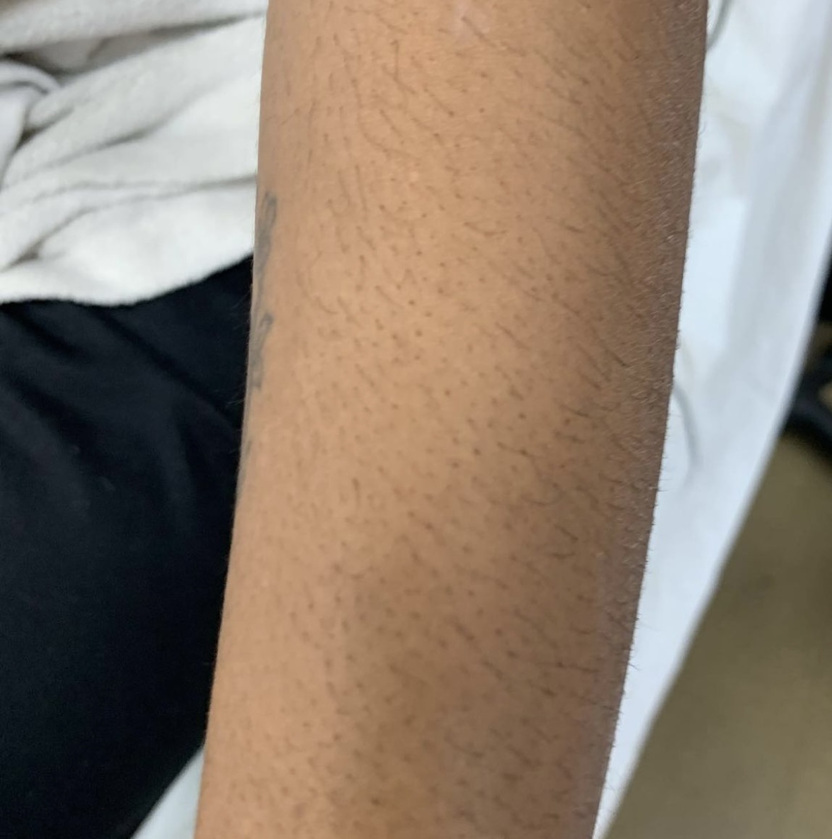 Full Arm wax