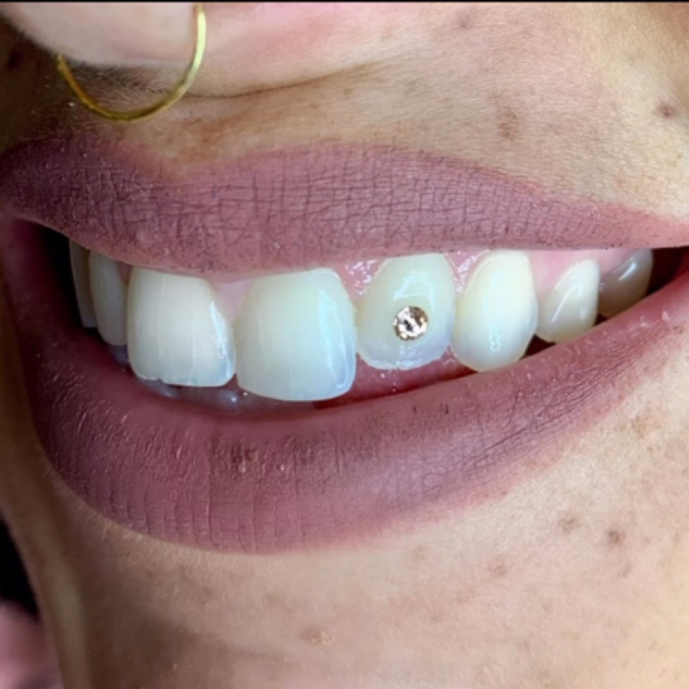 🧊 ROSE GOLD at BODY SCULPTING, BRAZILIAN WAXING, TEETH GEMS & WHITENING 📍NJ MOBILE in Hazlet, NJ
