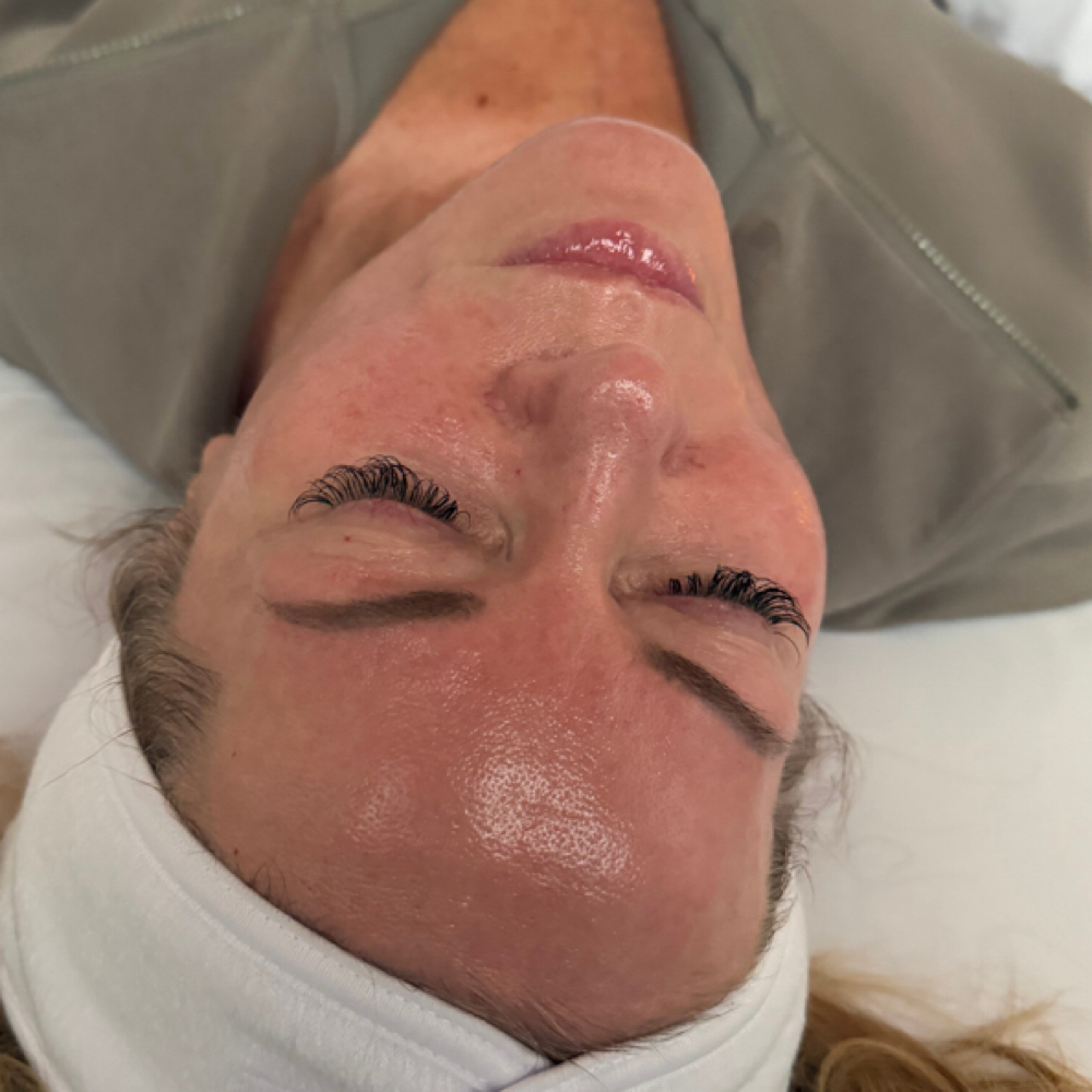 Skin Reset Peel at Altar Beauty Co. by Yury in Payette, ID