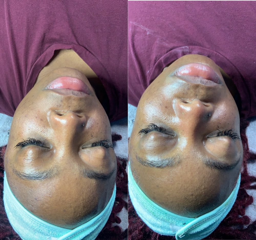 Express Facial