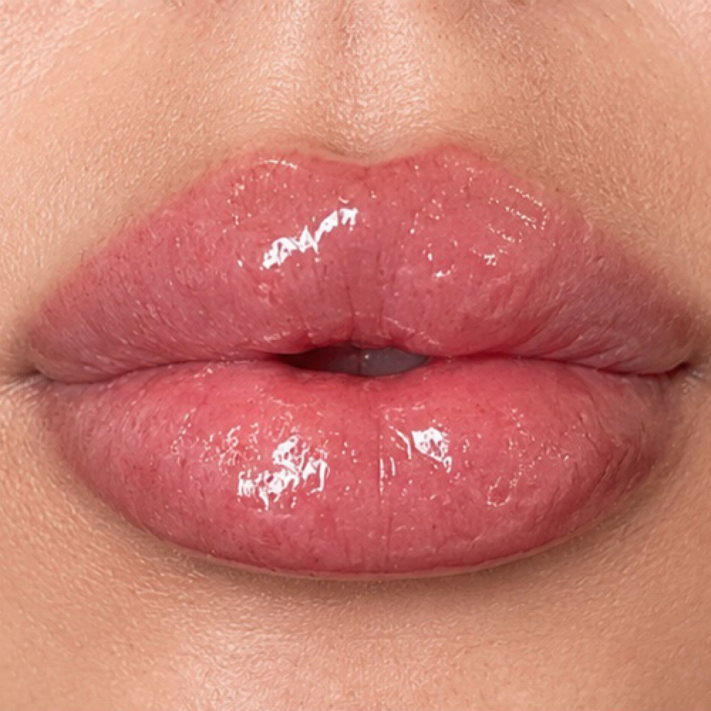 Full Syringe Dermal Filler at Alt Boutique & Aesthetics | Nurse Injector in Hereford, TX
