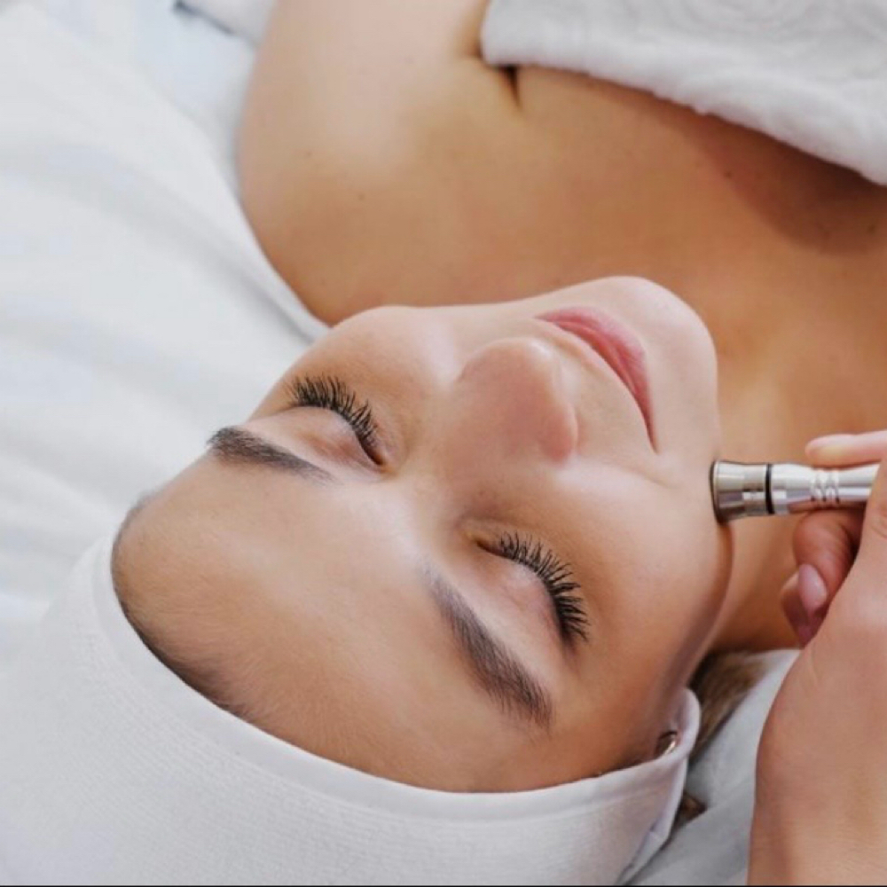 Microdermabrasion at Elite Beauty and Esthetics in Longview, WA