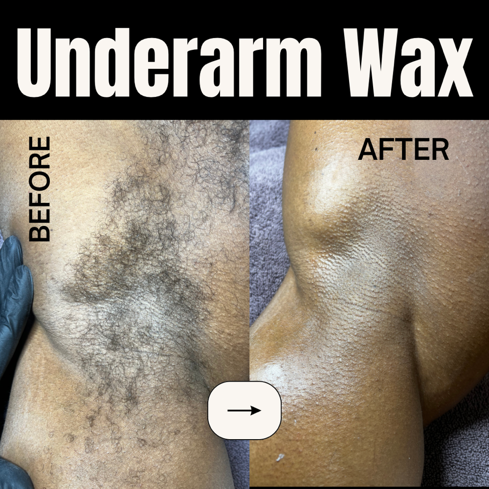 Waxing- Underarm