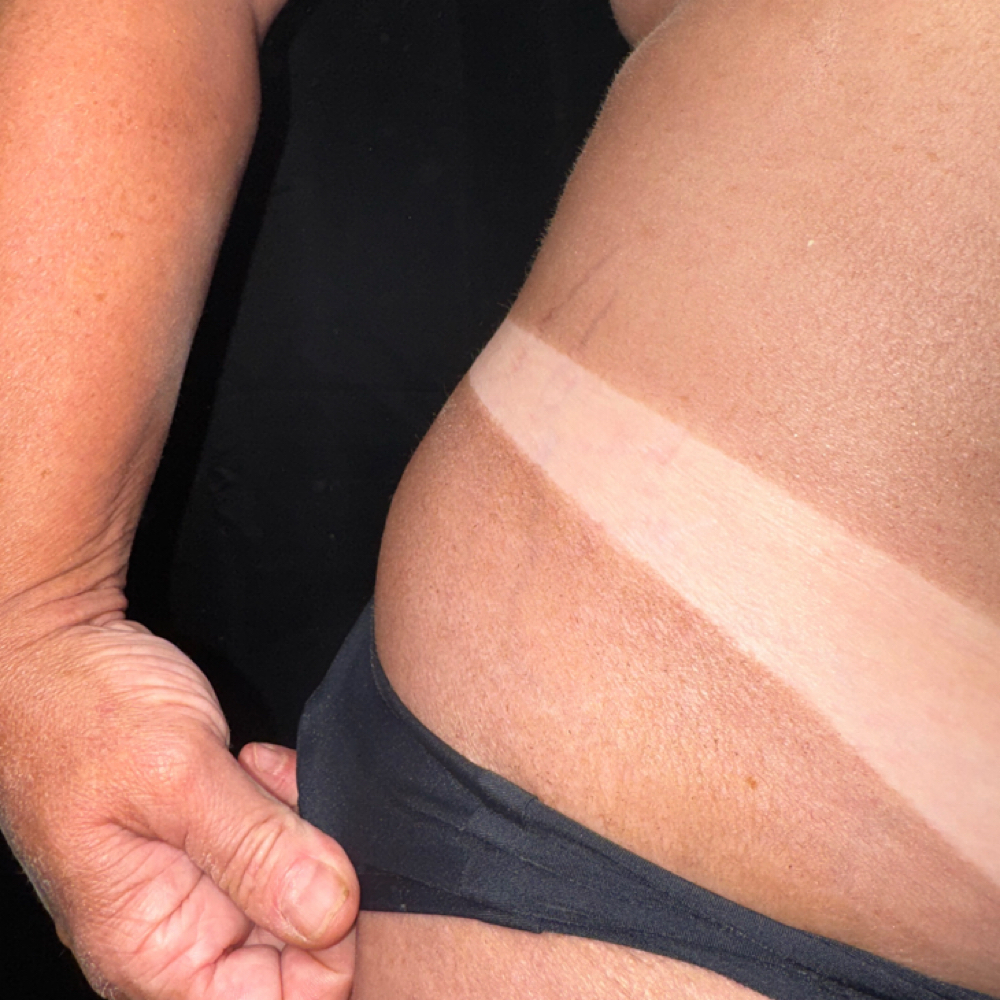 Spray Tan Rapid at SKN HAVEN in Fort Wayne, IN