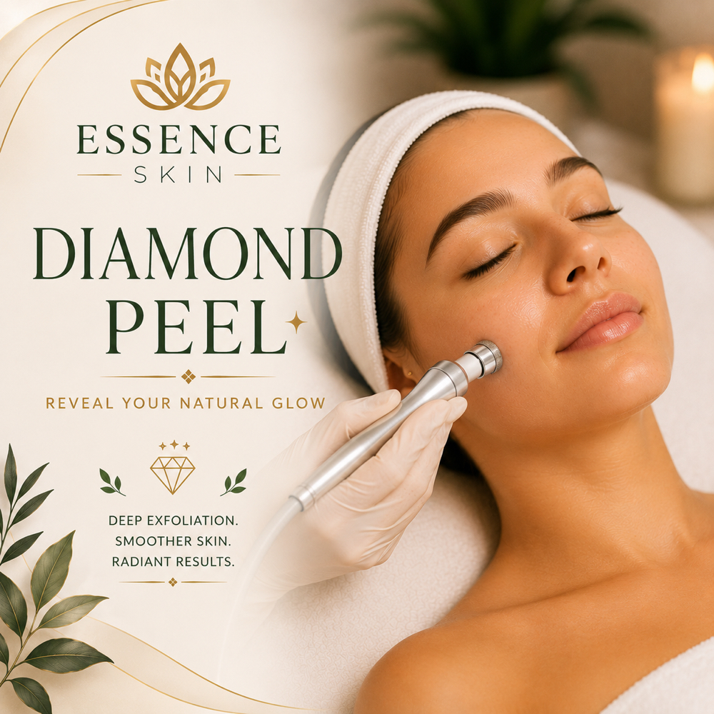 Diamond Peel at ESSENCE SKIN in Chelmsford, MA