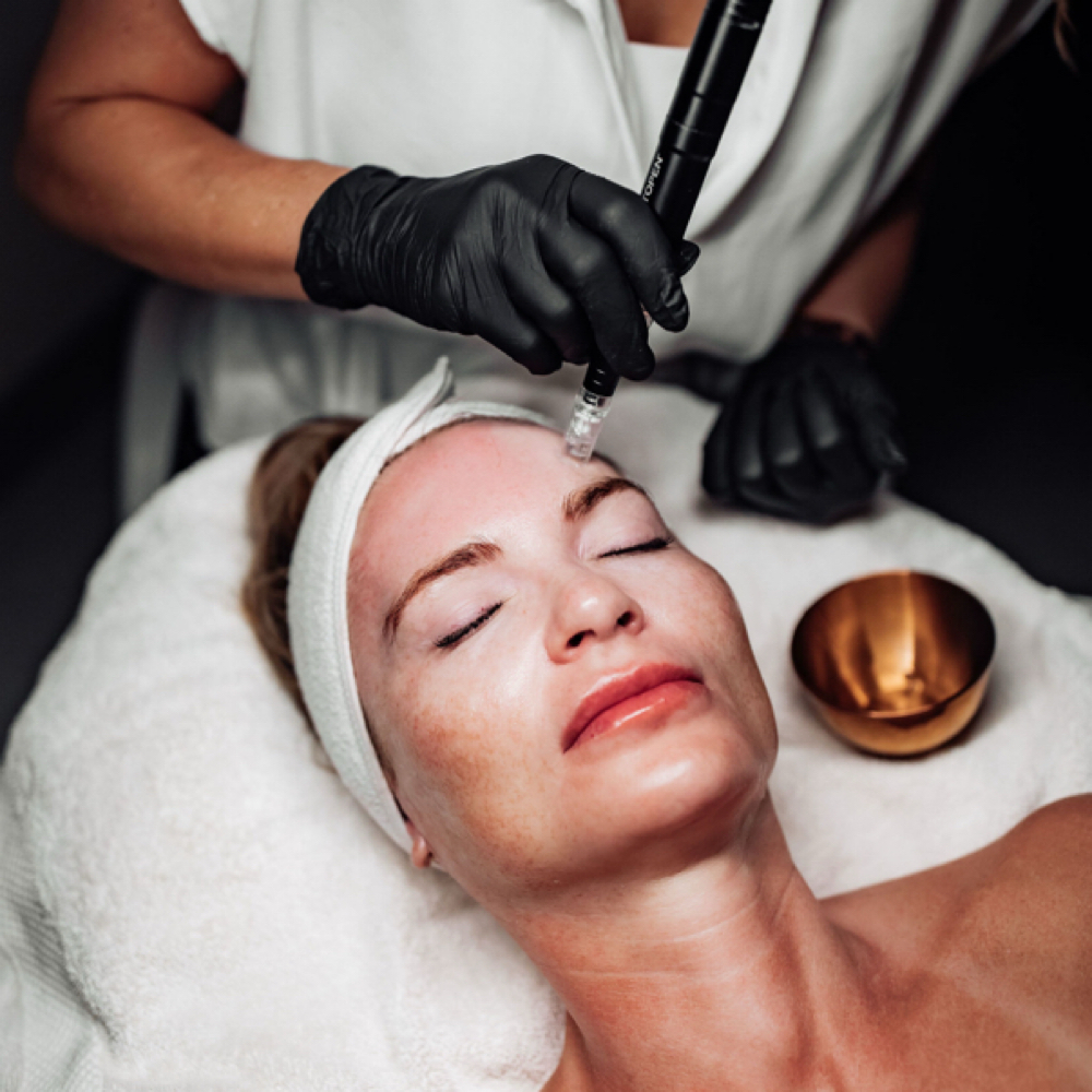 *New Client* Microneedling at Heather’s Luminous Esthetics in Tucson, AZ