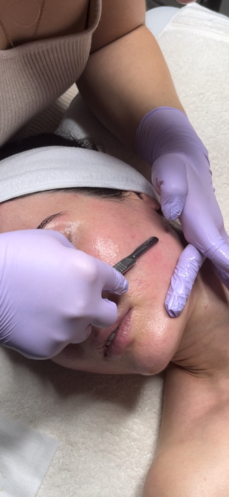 DERMAPLANE FACIAL