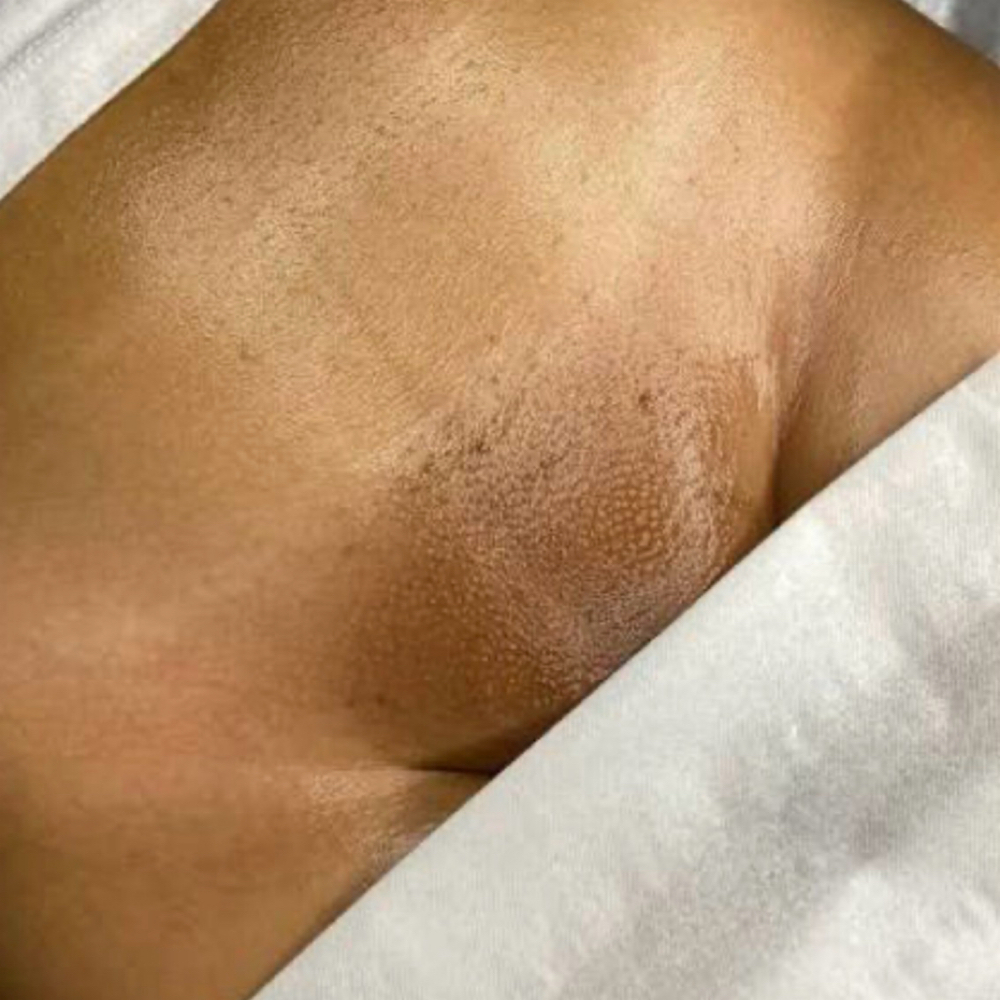 Brazilian Waxes at The Gleaux Lab/Charmed Beauty, LLC in West Monroe, LA