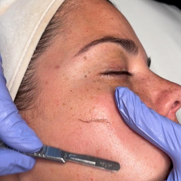 Dermaplaning Facial at Reona Spa in Gretna, LA