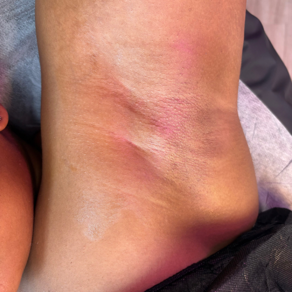 Model Underarm Wax at Nani au  —  3130 Collective in Slidell, LA