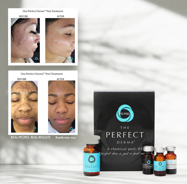 The Perfect Derma Peel at Alabaster Beauty Co in Scottsdale, AZ