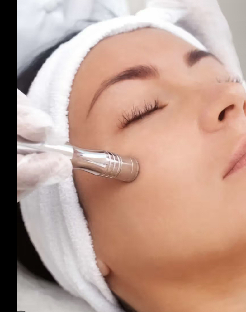 Glowify Facial (Microdermabrasion)