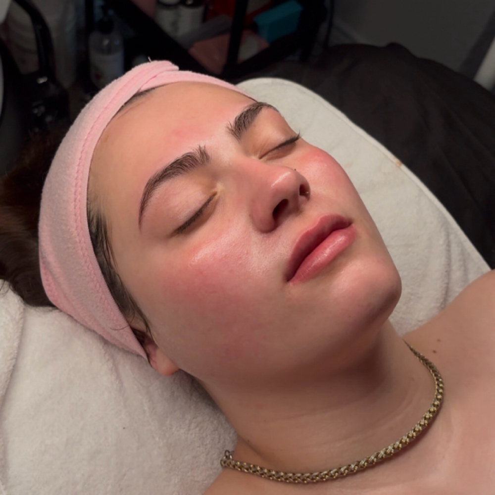 Classic Facial at Skin & Syringe Aesthetics in Rockwall, TX