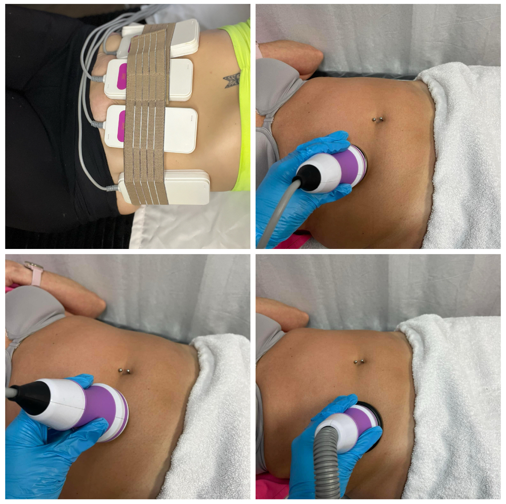 5 Pack Body Contouring Sessions