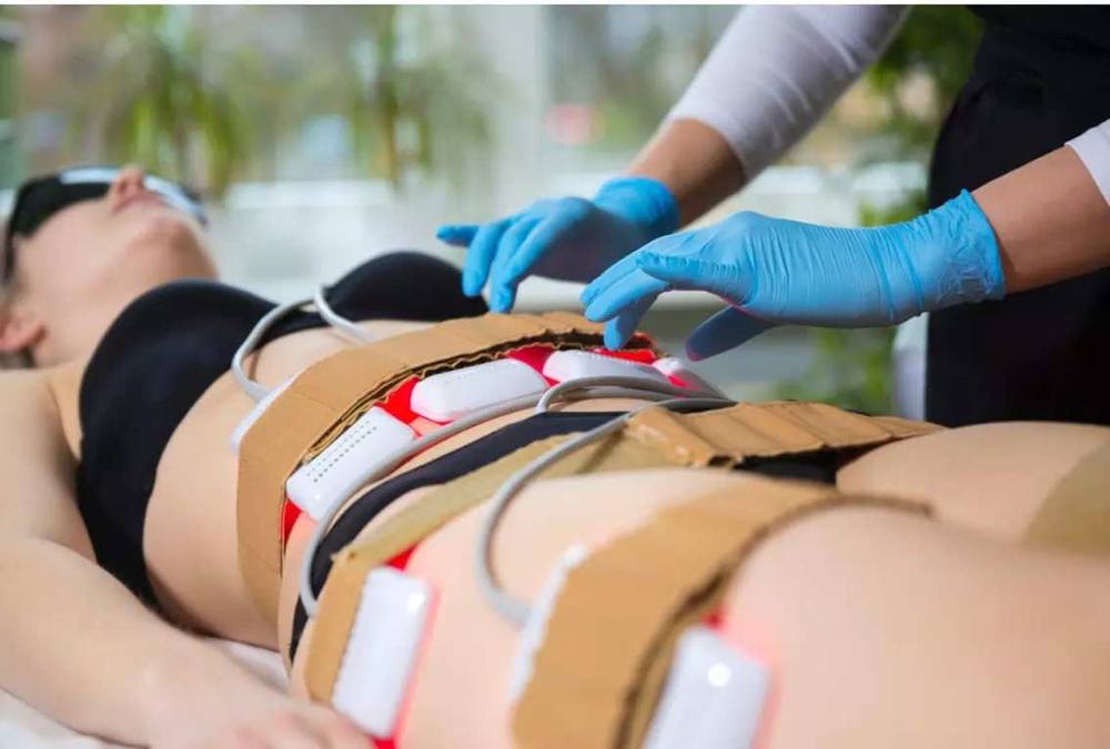 Laser Lipo