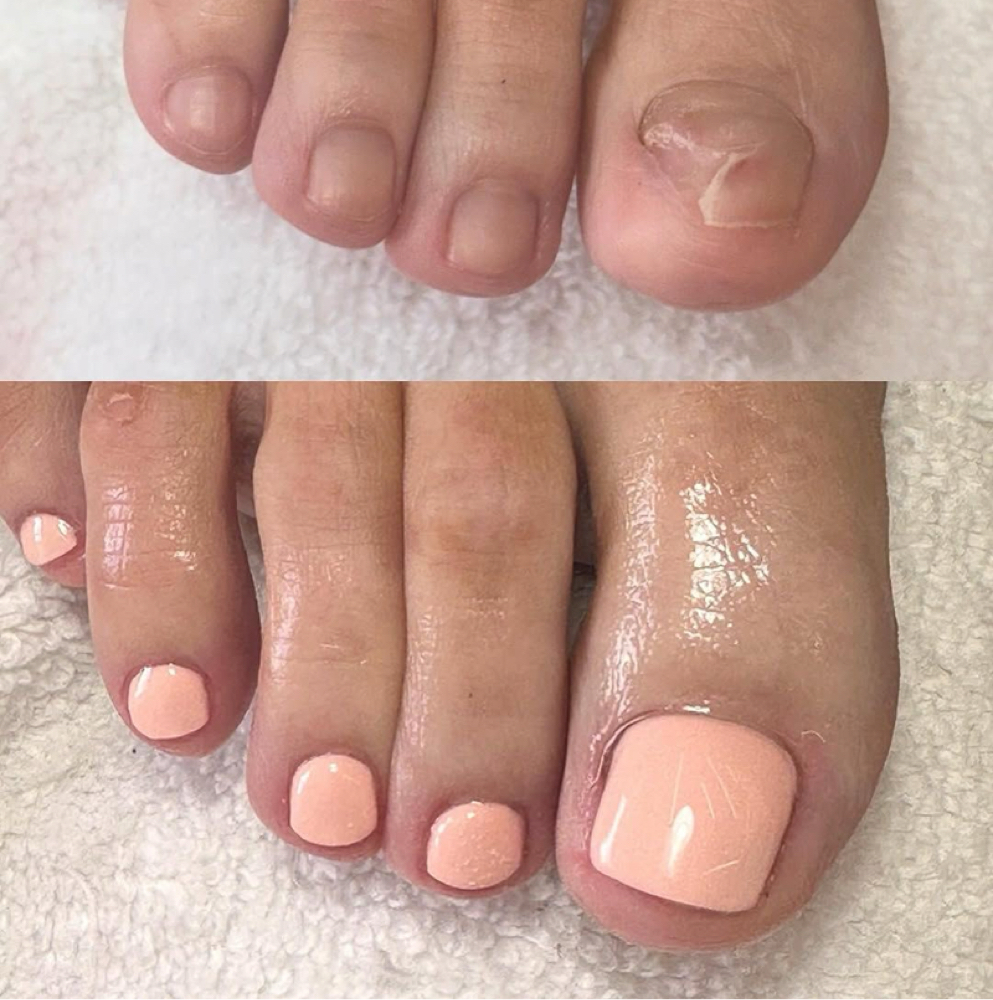 BBL for both Big Toes at Itz_JAMC Nails in Webster, TX