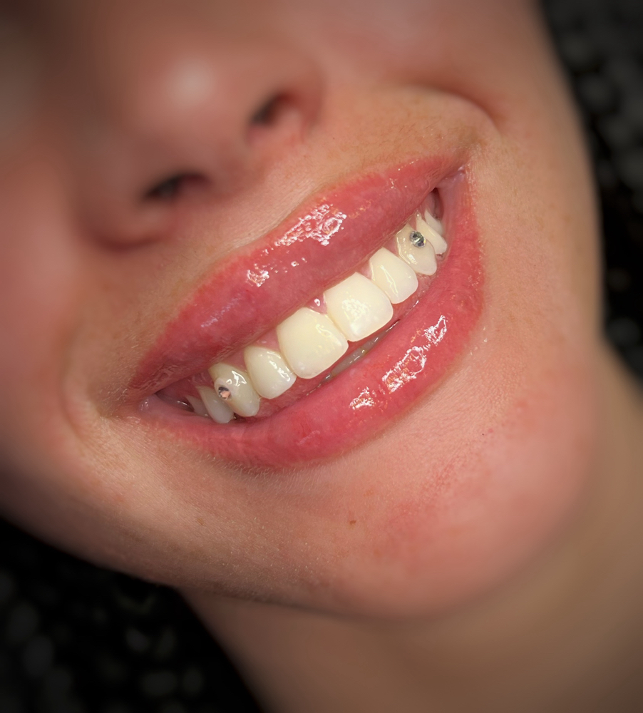 Teeth Whitening at Beauty by Cecily in Sparks, NV