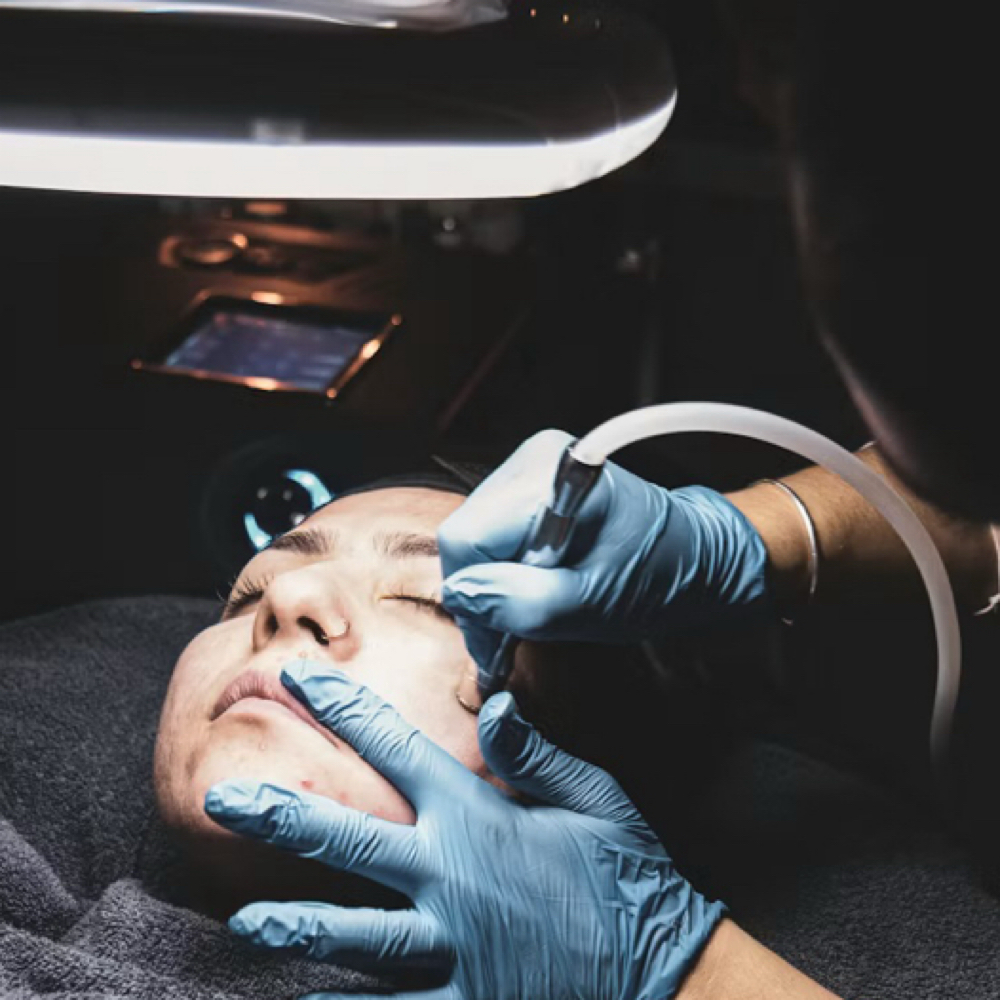 Diamond Facial at Belleza By Stef in Lake Elsinore, CA