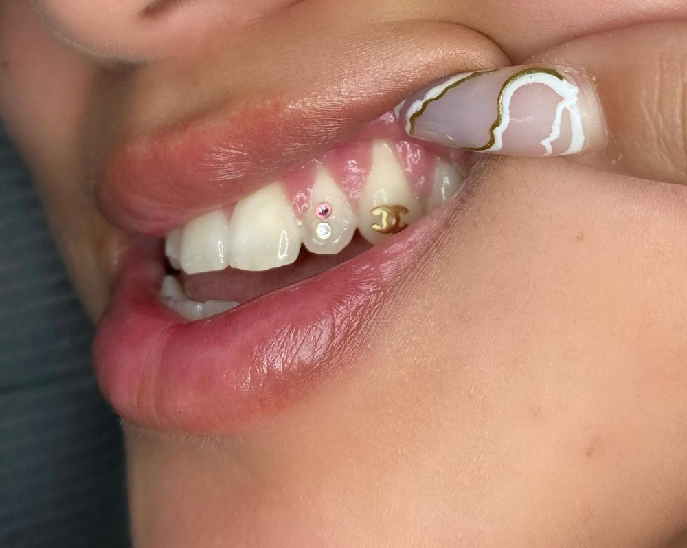 18kt Gold Tooth Gems