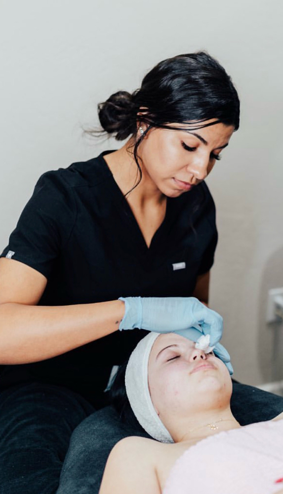Chemical Peel