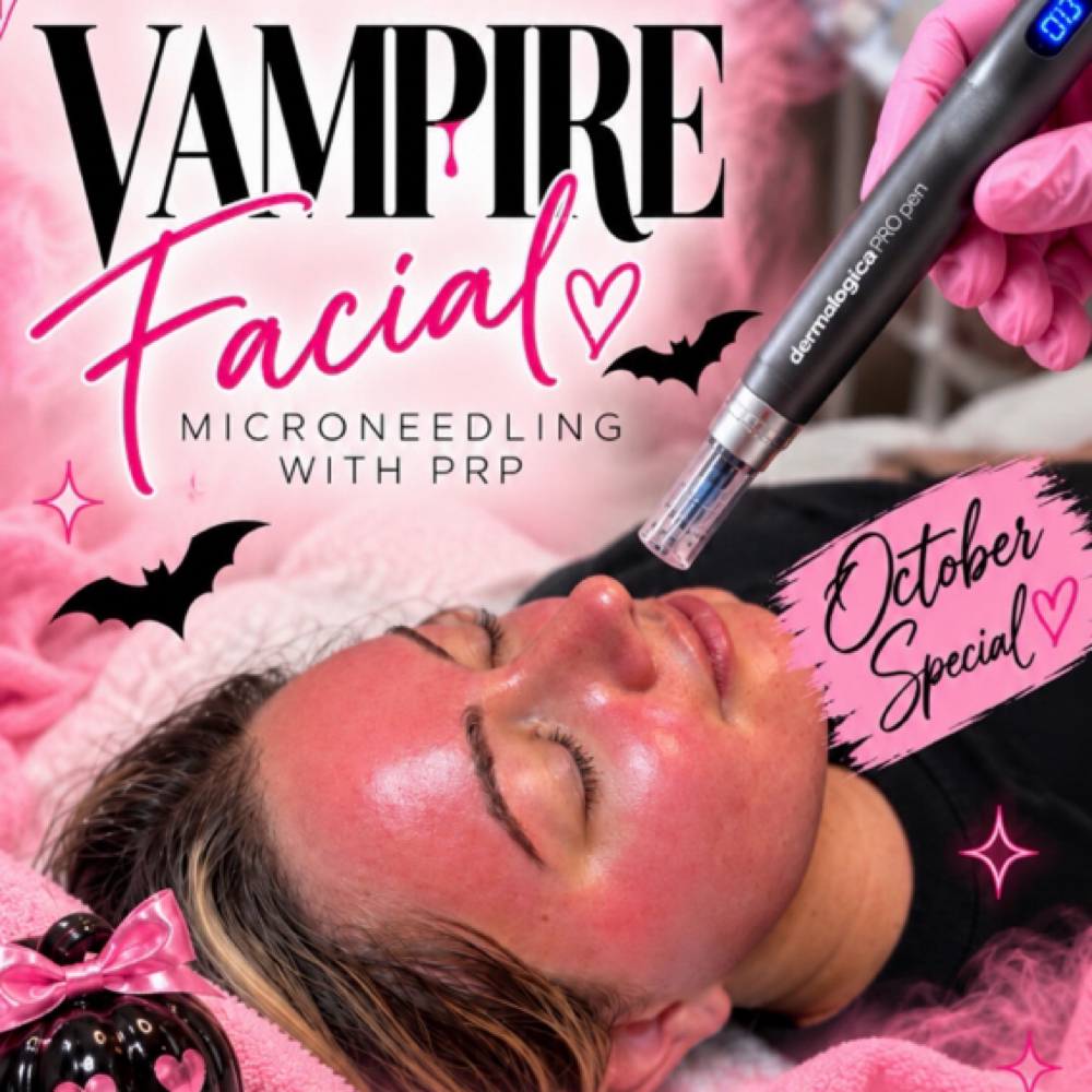 Vampire Facial- 3 Sessions at M.LO aesthetics + wellness in Waukesha, WI
