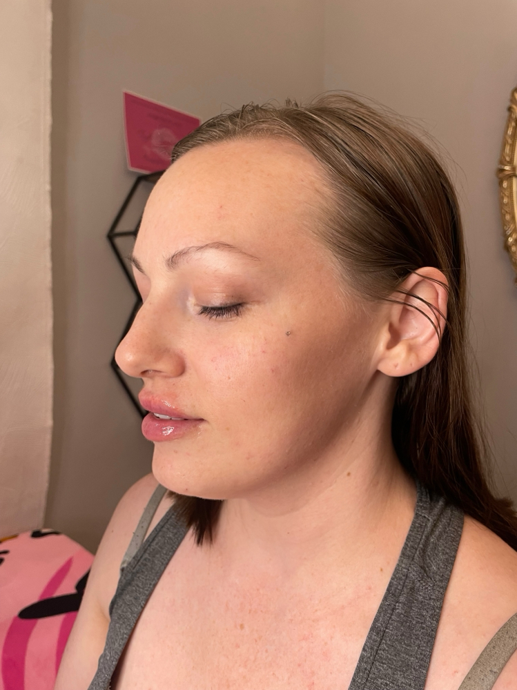 facial balancing.