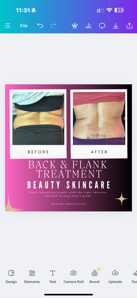 Back And Flanks Packages