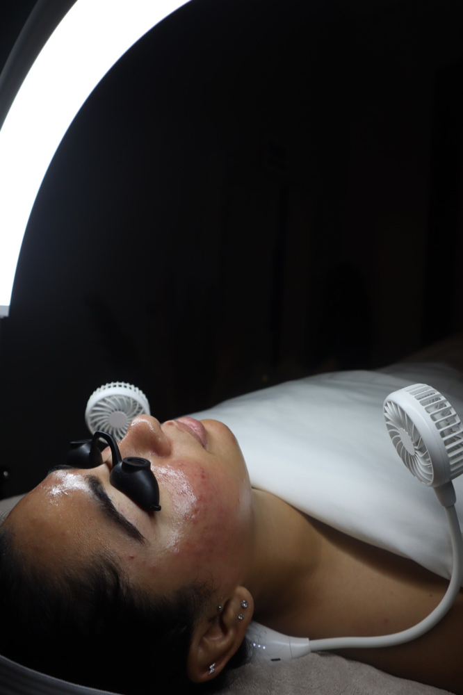 V Derm Peel Facial