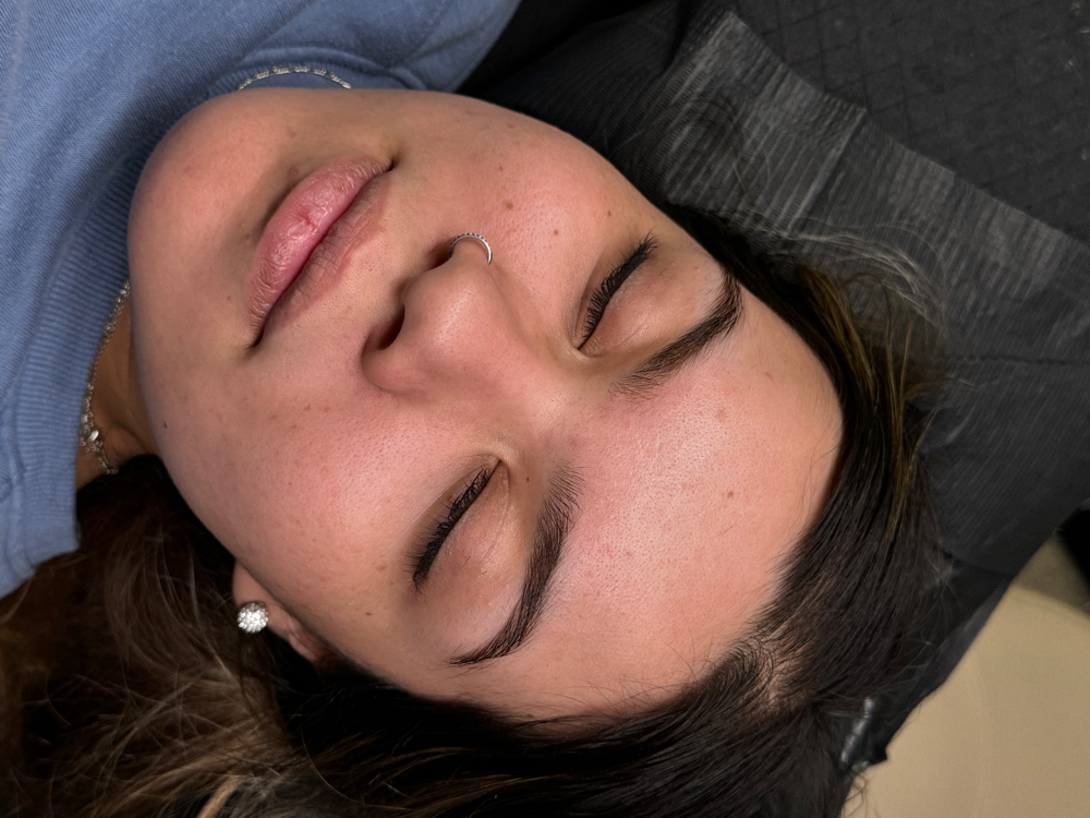 Brow Lightening Treatment
