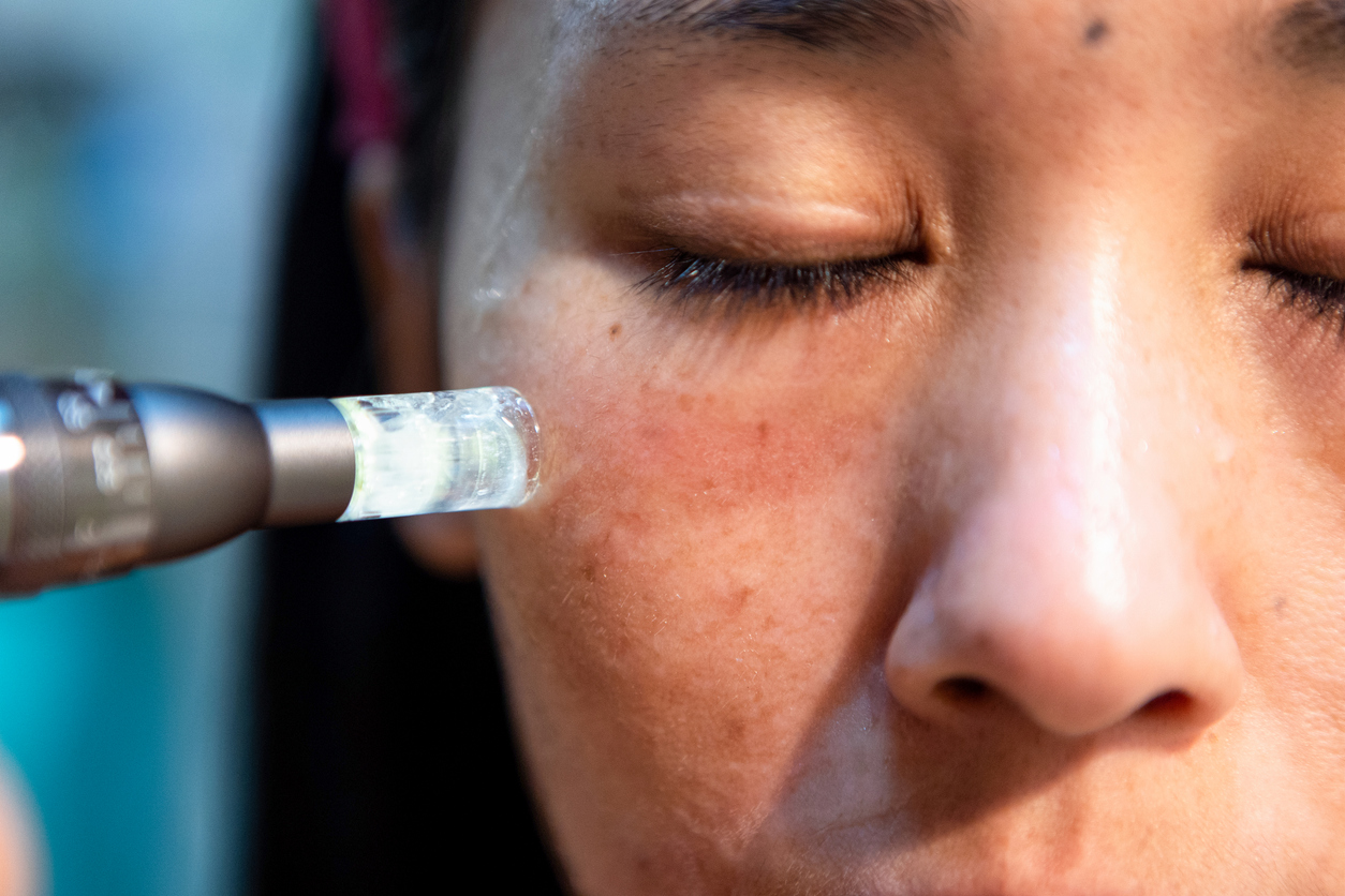 Basic stem cell facial