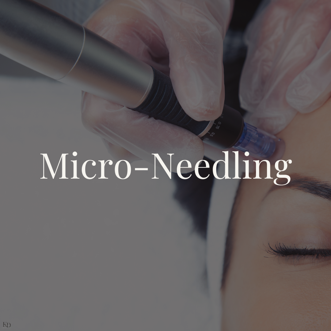 Micro-Needling