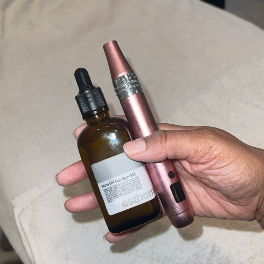 Nano Infusion at Capital Complexion in Washington, DC