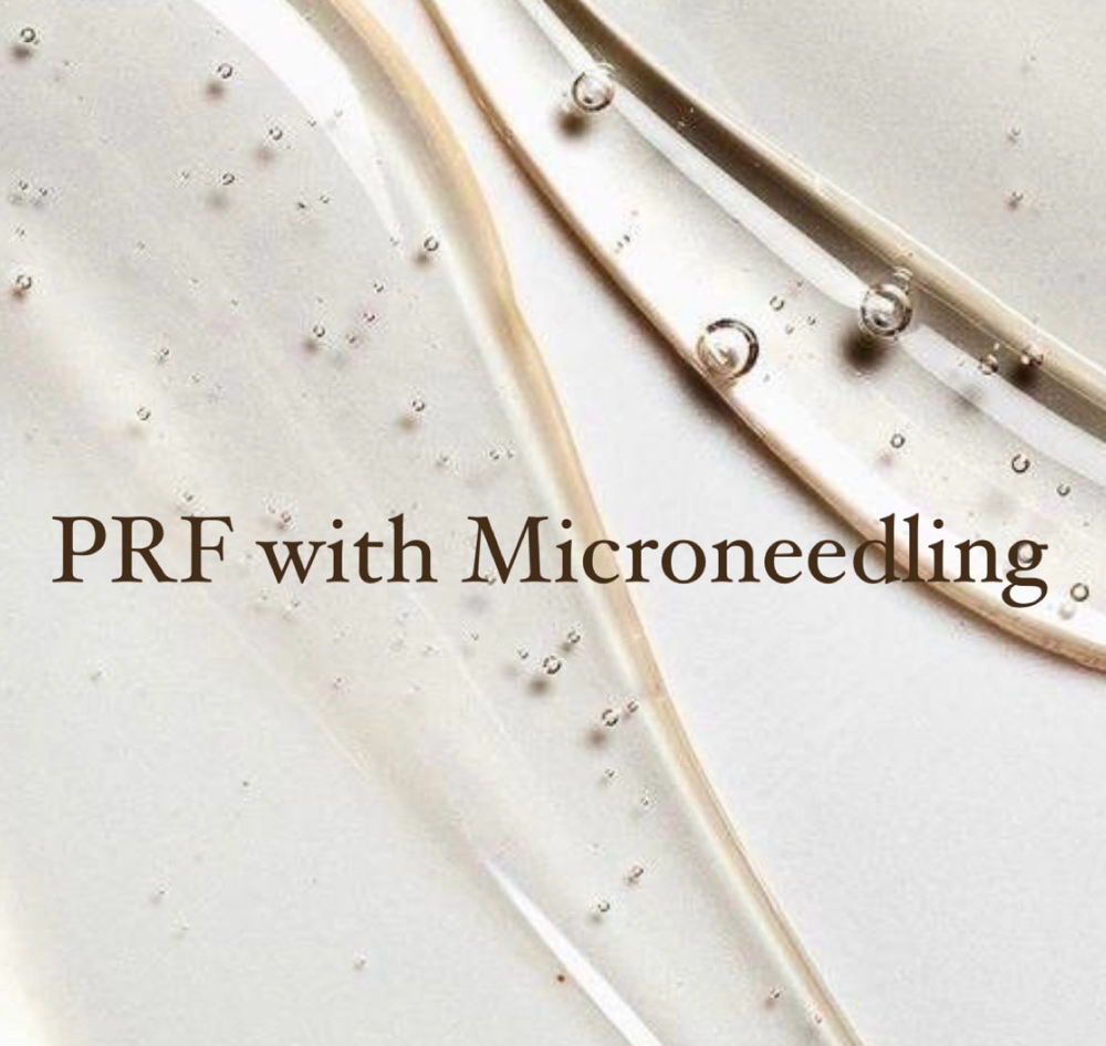 PRF with Microneedling