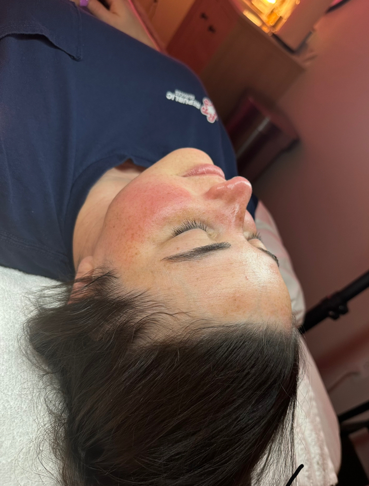 Dermaplane Treatment