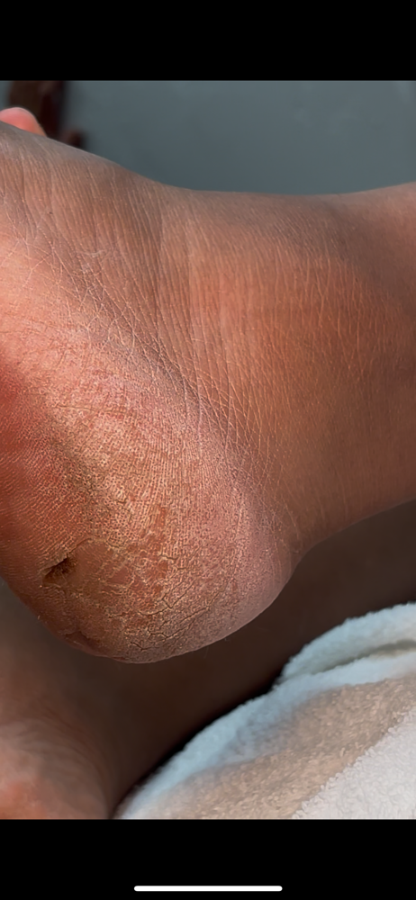 Renewal Dry Pedicure