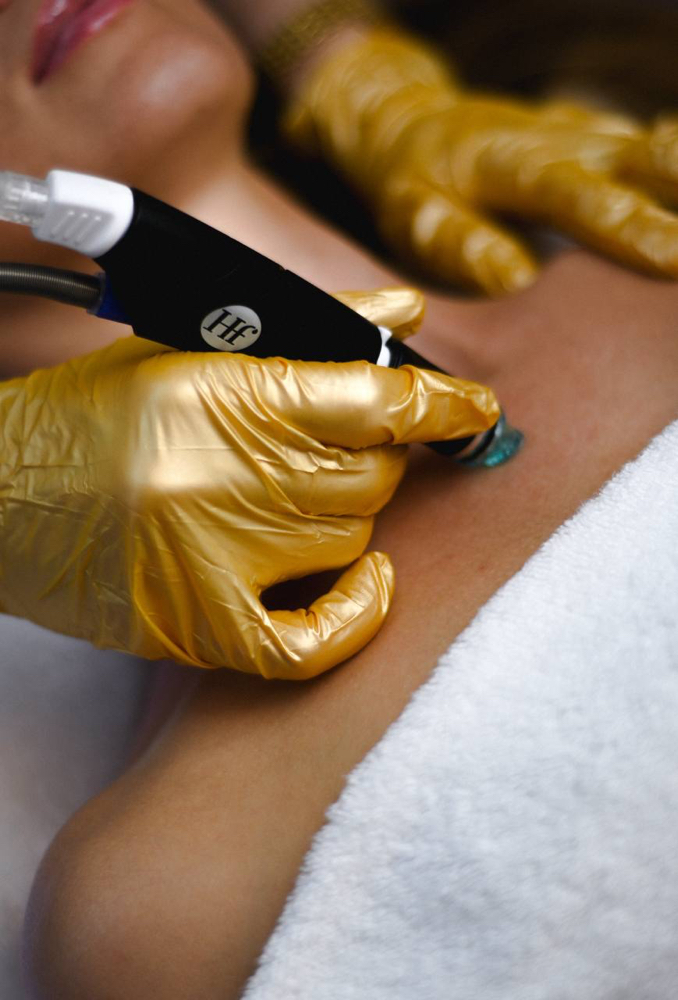 Hydrafacial neck & decollete at Skinfinity in Chicago, IL