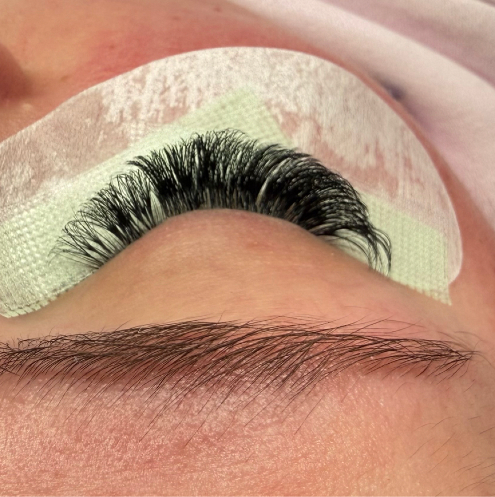 Volume Fill at Diverse Esthetics in Depew, NY