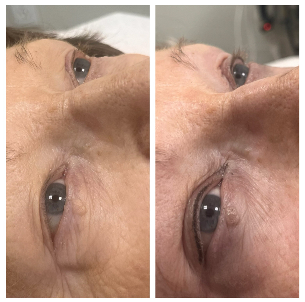 Water Eyeliner Permanent Makeup at Nina Beauty&Brows Studio in North Hollywood, CA