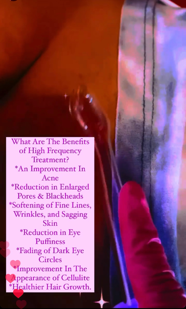 High Frequency