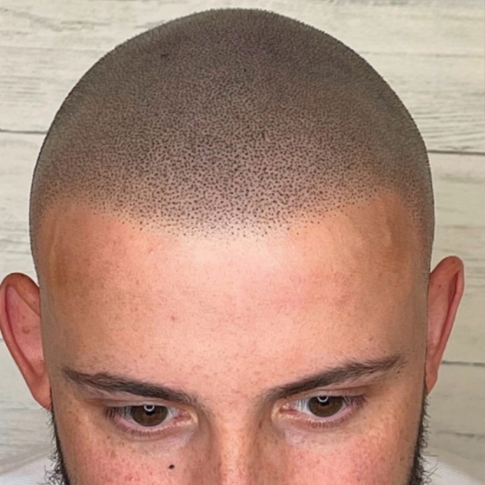 Scalp Micro pigmentation at Beautyy By RD in Beaumont, CA