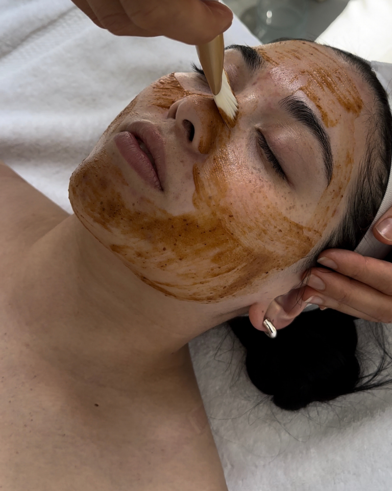 Chemical Peel & Facial