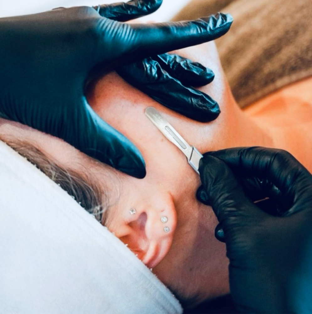 Dermaplane Facial at The Juniper LLC in BARGERSVILLE, IN