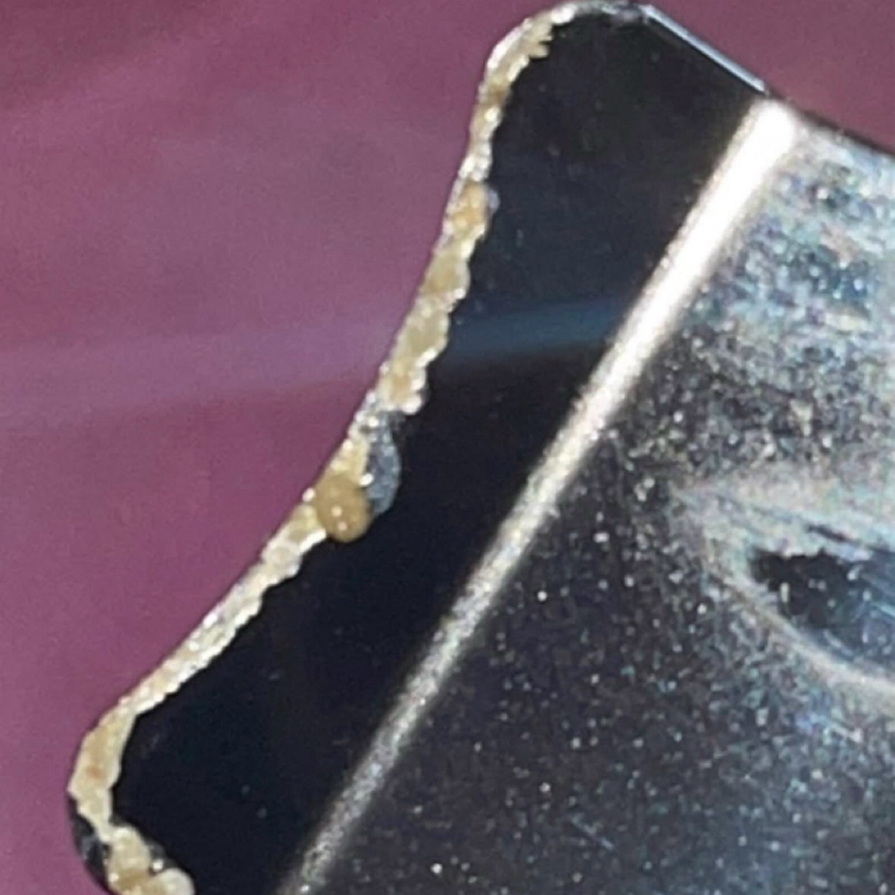 Ingrown Extractions at Lins Esthetics in Gaithersburg, MD