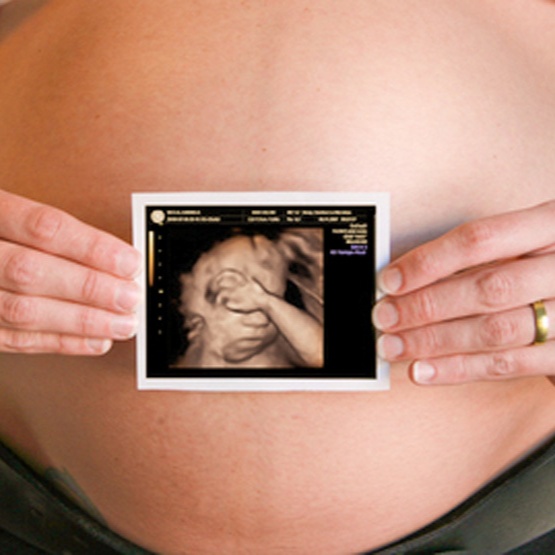 3D4D Ultrasound at San Bernardino 3D 4D Ultrasound by 4D Special Delivery in San Bernardino, CA