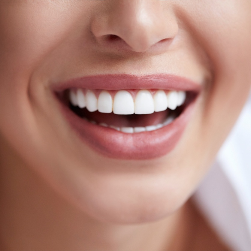 Teeth Whitening at Wink Lash Studio in St. George, UT