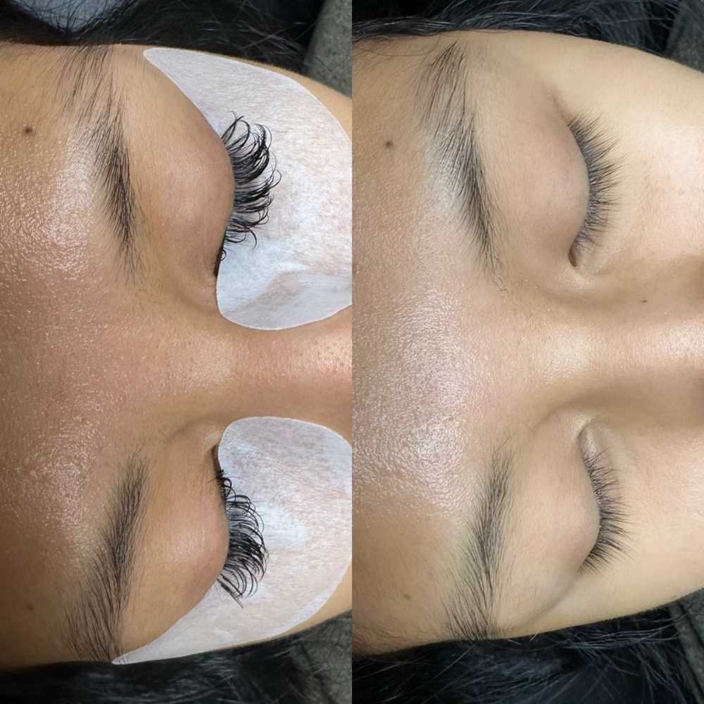 Lash Removal