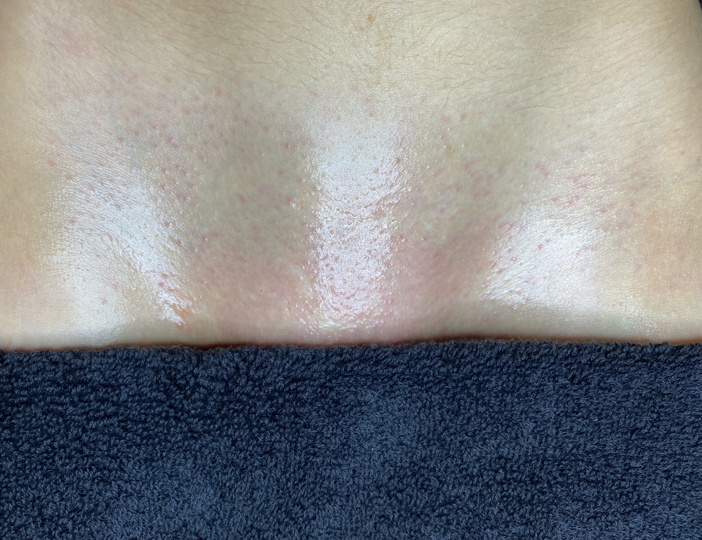 Brazilian Wax (Female Anatomy)