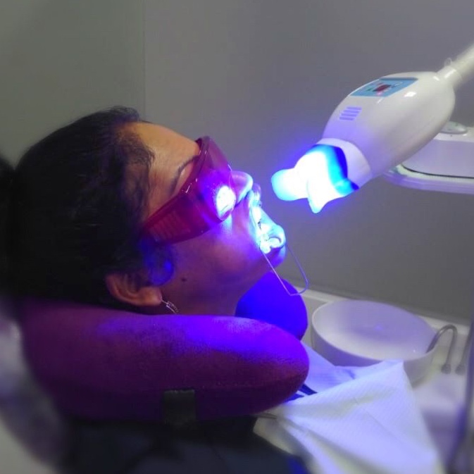 Professional Teeth Whitening at London Luxe in Haverstraw, NY
