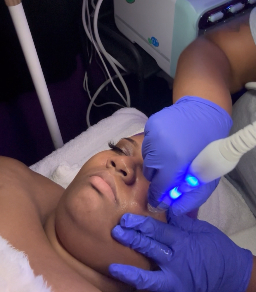 The Radiance Renewal Facial